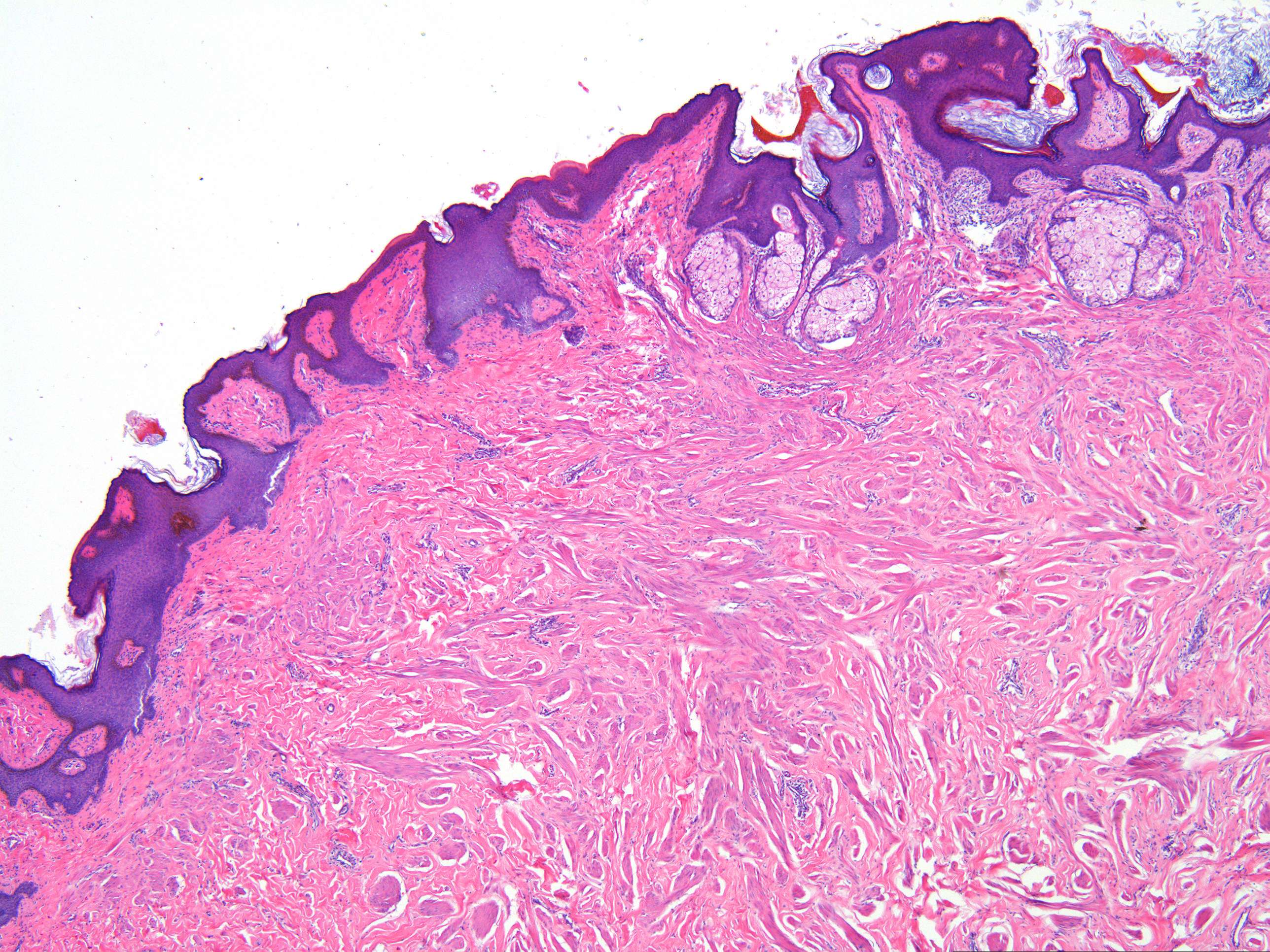 Papilla mammaria (40 X) - Anatomicum.com