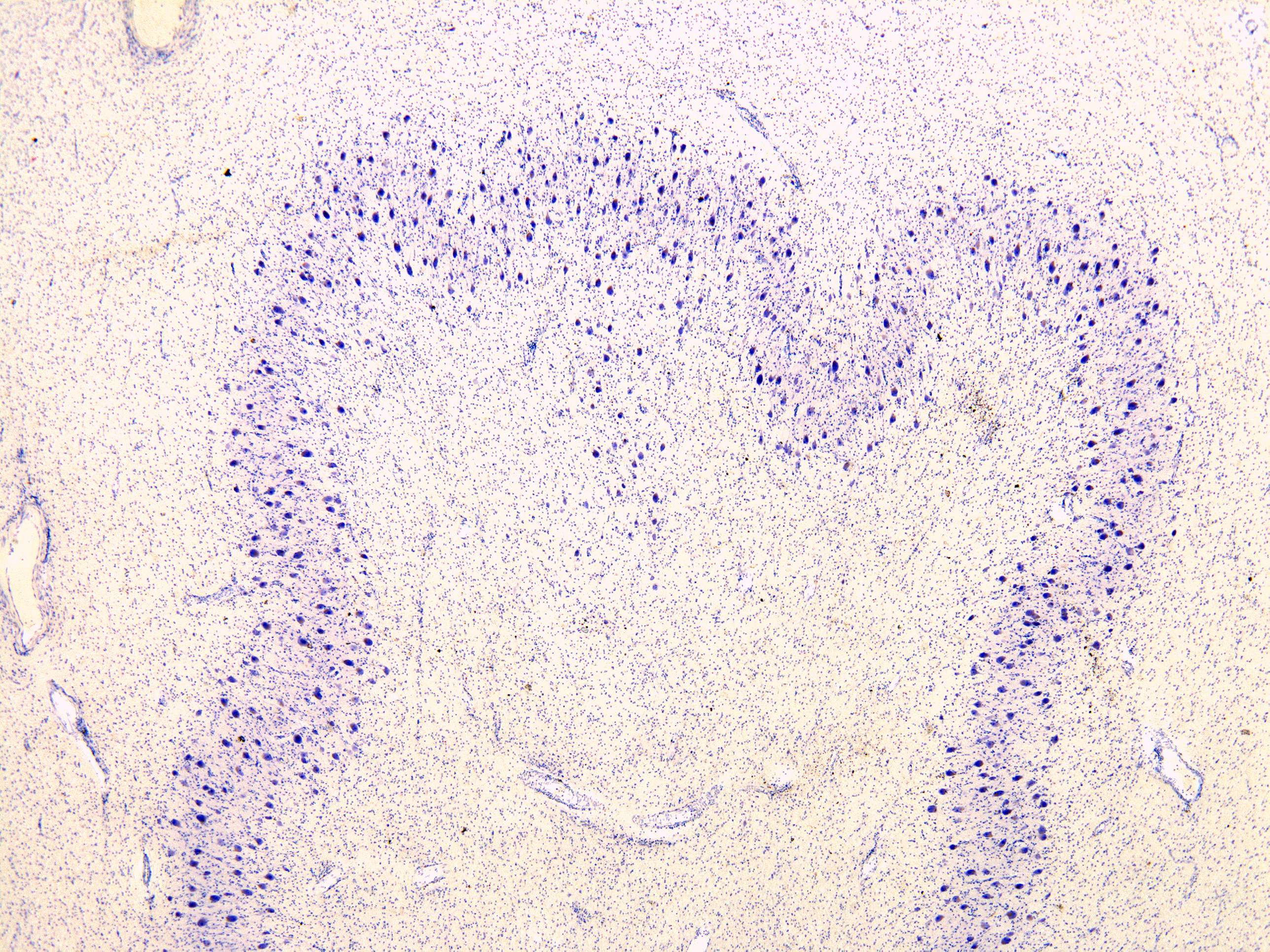 The dentate nucleus of the cerebellum (40 X) - Anatomicum.com